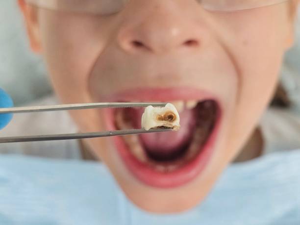 Best Weekend Emergency Dentist in Brookland, AR