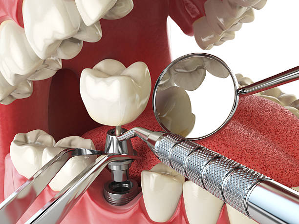 Best Emergency Dental Services for Seniors in Brookland, AR